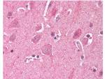 LDB2 Antibody in Immunohistochemistry (Paraffin) (IHC (P))
