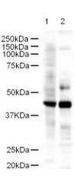LDB2 Antibody in Western Blot (WB)