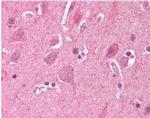 LDB2 Antibody in Immunohistochemistry (Paraffin) (IHC (P))