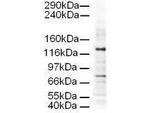AP3D1 Antibody in Western Blot (WB)