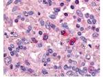 Artemis Antibody in Immunohistochemistry (Paraffin) (IHC (P))