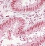 NUP50 Antibody in Immunohistochemistry (Paraffin) (IHC (P))