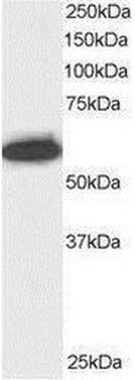 NUP50 Antibody in Western Blot (WB)