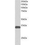 ALS2CR2 Antibody in Western Blot (WB)
