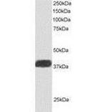ALS2CR1 Antibody in Western Blot (WB)