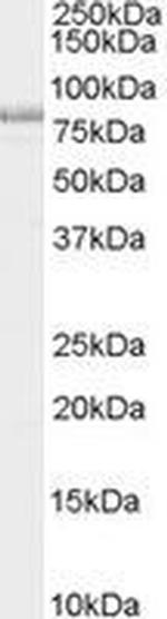 NUMB Antibody in Western Blot (WB)
