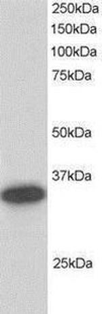 CBR1 Antibody in Western Blot (WB)