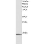 HSPB8 Antibody in Western Blot (WB)