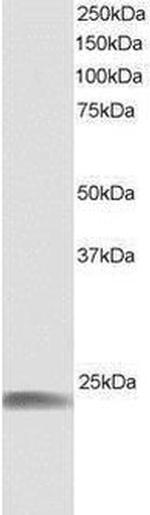 HSPB8 Antibody in Western Blot (WB)