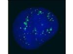 PCSK2 Antibody in Immunocytochemistry (ICC/IF)