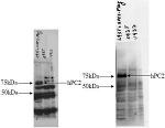 PCSK2 Antibody in Western Blot (WB)