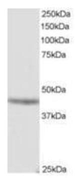 MURF3 Antibody in Western Blot (WB)