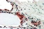 TRIP15 Antibody in Immunohistochemistry (Paraffin) (IHC (P))