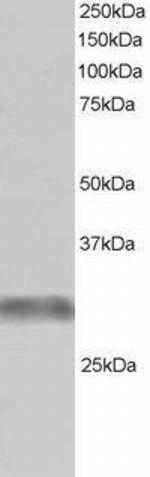 RNF90 Antibody in Western Blot (WB)