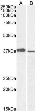 MEL18 Antibody in Western Blot (WB)