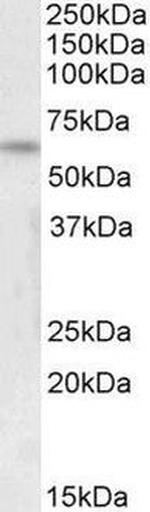 ILF1 Antibody in Western Blot (WB)
