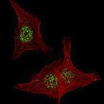 FGFR4 Antibody in Immunocytochemistry (ICC/IF)