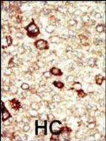 FGFR4 Antibody in Immunohistochemistry (Paraffin) (IHC (P))