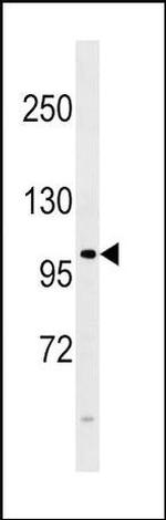 FGFR4 Antibody in Western Blot (WB)