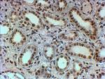 PTBP1 Antibody in Immunohistochemistry (Paraffin) (IHC (P))