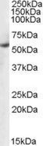 PTBP1 Antibody in Western Blot (WB)