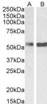 PTBP1 Antibody in Western Blot (WB)