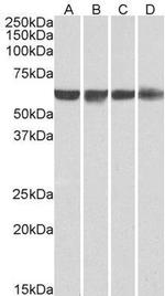 PTBP1 Antibody in Western Blot (WB)