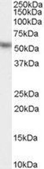 KPNA2 Antibody in Western Blot (WB)
