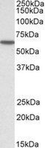 KPNA3 Antibody in Western Blot (WB)