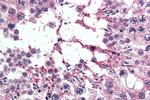 RanBP16 Antibody in Immunohistochemistry (Paraffin) (IHC (P))
