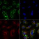 ABCA1 Antibody in Immunocytochemistry (ICC/IF)