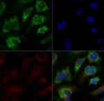ABCA1 Polyclonal Antibody