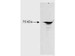 RFX5 Polyclonal Antibody