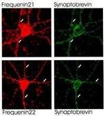 Frequenin Antibody in Immunocytochemistry (ICC/IF)