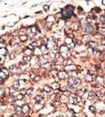 MMP17 Polyclonal Antibody