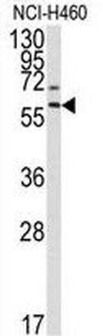 MMP17 Antibody in Western Blot (WB)