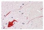SHP2 Antibody in Immunohistochemistry (Paraffin) (IHC (P))