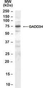 GADD34 Antibody in Western Blot (WB)
