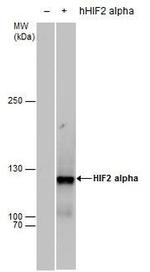 HIF-2 alpha Antibody in Western Blot (WB)