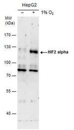 HIF-2 alpha Antibody in Western Blot (WB)