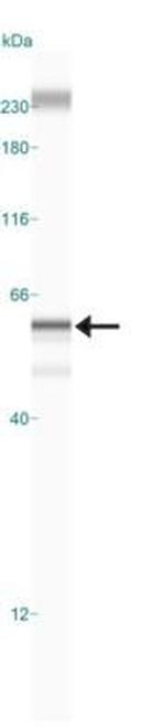 BMAL1 Antibody in Western Blot (WB)