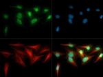 Tankyrase Antibody in Immunocytochemistry (ICC/IF)