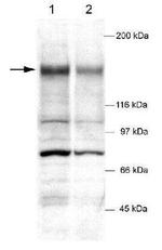 Tankyrase Antibody in Western Blot (WB)