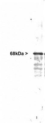 NEFL Antibody in Western Blot (WB)