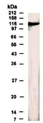 GABBR1 Antibody in Western Blot (WB)