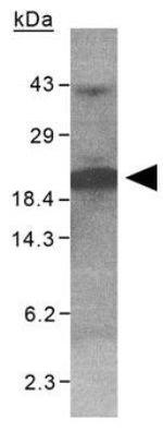 XAGE1 Antibody in Western Blot (WB)