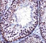 DNMT3B Antibody in Immunohistochemistry (IHC)