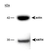 NTHL1 Antibody in Western Blot (WB)