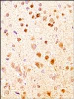 NKB Polyclonal Antibody