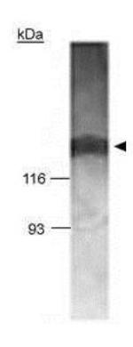 BRCAA1 Antibody in Western Blot (WB)